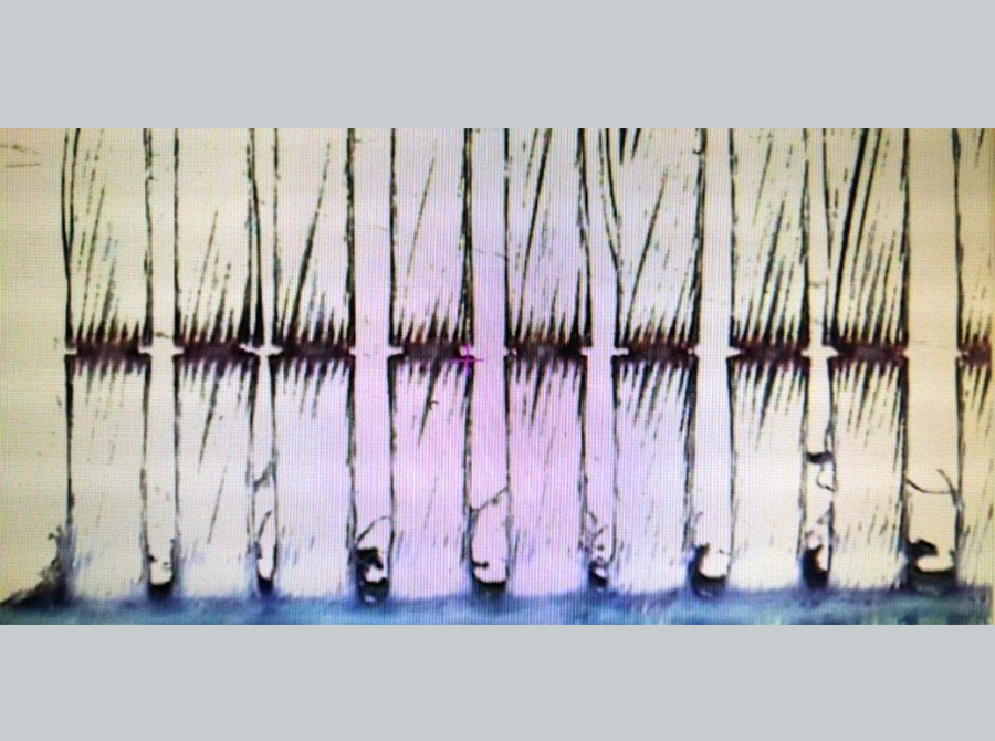 ca888亚洲城激光官网