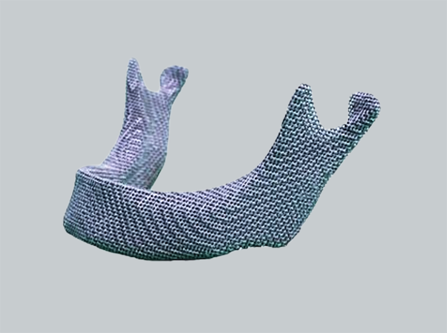 ca888亚洲城激光官网